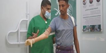 بعد تعرضه لحادث مروع.. "سلمان للإغاثة" يعيد الحياة لشاب يمني بتركيب طرف صناعي
