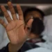 الولايات المتحدة تسجل أول إصابة بسلالة فرعية من جدري القردة