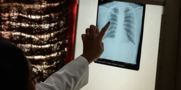 دراسة: تدخين 20 سيجارة يمكن أن تقصر عمر الشخص بنحو 7 ساعات