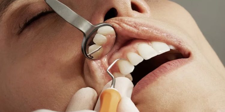 "أسنان أوزمبيك".. أحدث الآثار الجانبية المزعجة لدواء إنقاص الوزن