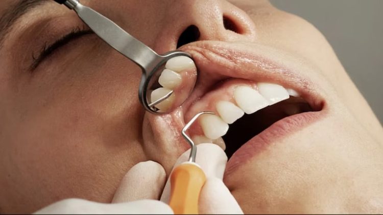 "أسنان أوزمبيك".. أحدث الآثار الجانبية المزعجة لدواء إنقاص الوزن