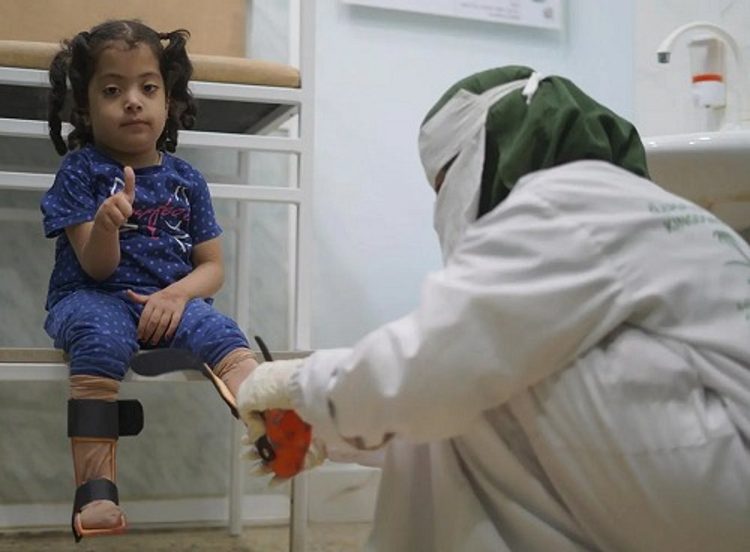 بدعم من المملكة.. مركز الأطراف الصناعية في حضرموت يُقدم خدماته لـ 775 مستفيدًا خلال مايو