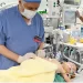 أكثر من 60 عملية فصل ناجحة.. المملكة تتصدر «طب المعجزات» عالميا