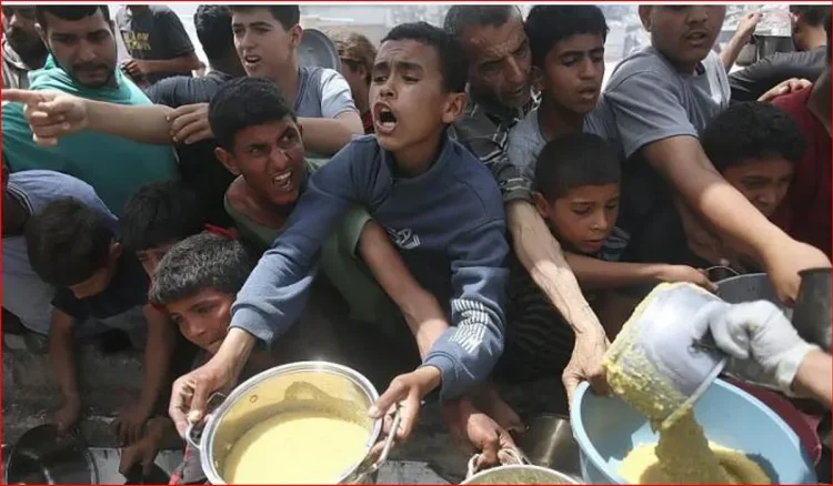 مجمع الشفاء الطبي: وفاة 21 طفلًا جراء المجاعة في غزة