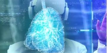استشاري: تقنيات الذكاء الاصطناعي أثبتت قدرتها في تشخيص مرض السل دون الحاجة لأجهزة الأشعة