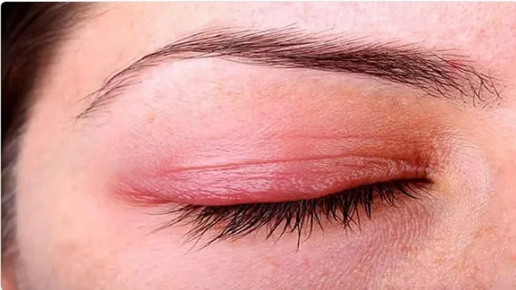 استشاري يحذر من عادات يومية خاطئة تضر العين