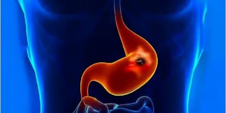 استشاري يقدم نصائح طبية للوقاية من جرثومة المعدة