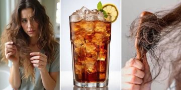 دراسة حديثة تحذر: السكريات تزيد تساقط الشعر