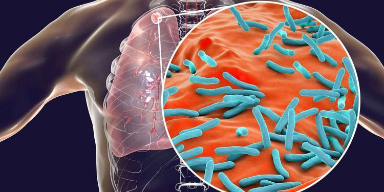 علماء يحددون البكتيريا المسؤولة عن أول جائحة في التاريخ البشري