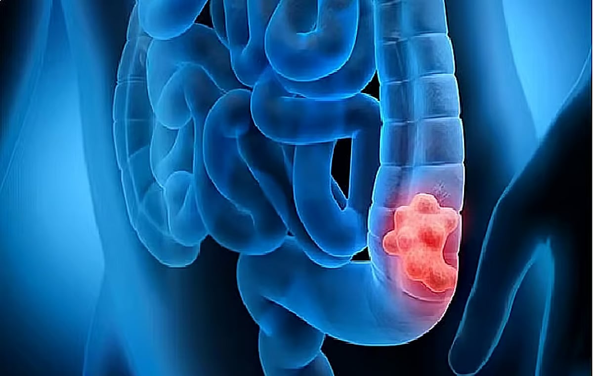 دراسة: العمل الدائم بنوبات ليلية مرتبط بالقولون العصبي