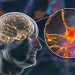 دراسة طبية تكشف عن مؤشر بيولوجي لتسارع شيخوخة الدماغ