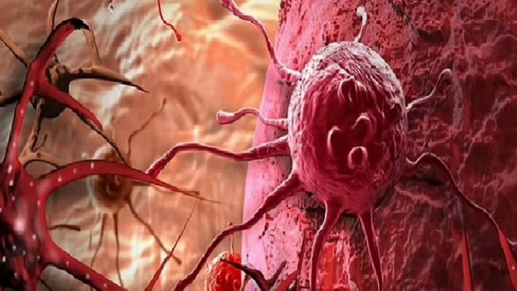 باحثون يطورون علاجًا ضوئيًا يقضي على الخلايا السرطانية