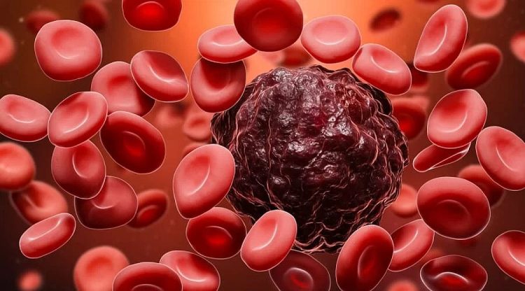 اكتشاف استراتيجية جديدة لعلاج سرطان الدم دون الإضرار بالمناعة