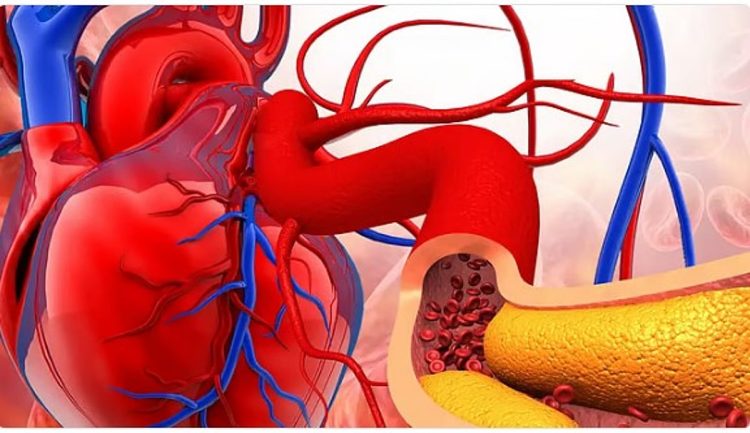 الخضيري يوضح أسباب تصلب الشرايين وطرق الوقاية