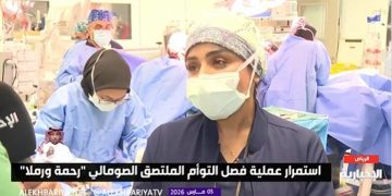 استشارية: عمليات فصل التوأم صعبة ومعقدة ويدخل بها 6 تخصصات