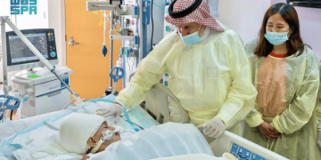 الدكتور الربيعة: استقرار حالة التوأم الفلبيني «كليا وموريس آن» بعد أسبوع من عملية فصلهما