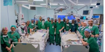 الفريق الطبي يستكمل فصل التوأم الملتصق "كليا وموريس آن" بعد عملية جراحية معقدة