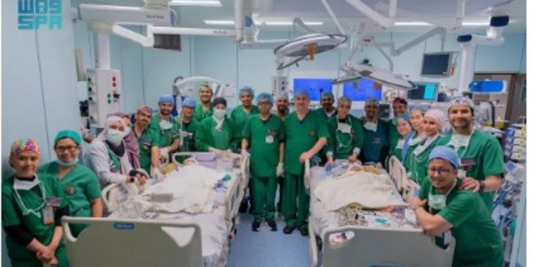 الفريق الطبي يستكمل فصل التوأم الملتصق "كليا وموريس آن" بعد عملية جراحية معقدة