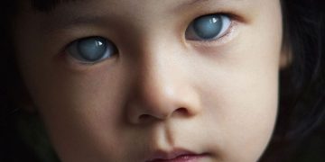 جلوكوما العين: كيف تحمي بصرك من “السارق الصامت” للبصر؟- الكحال