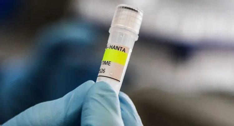 بريطانيا: الاشتباه في إصابة مواطن ثالث بفيروس هانتا