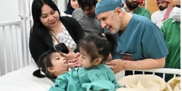 إنفاذًا لتوجيهات خادم الحرمين وولي العهد.. بدء عملية فصل التوأم الملتصق الفلبيني (أوليفيا وجيانا)