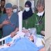 استشاري يروي أبرز التحديات في عملية فصل التوأم الفلبيني