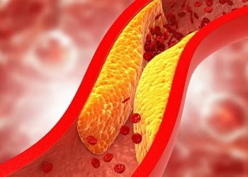 «الخضيري»: 10 نصائح لعلاج ارتفاع الكوليسترول