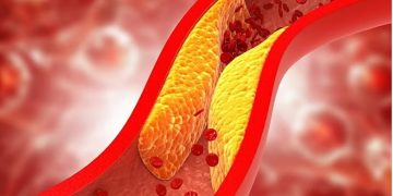«الخضيري»: 10 نصائح لعلاج ارتفاع الكوليسترول