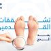 بعد الحج.. 4 أعراض تكشف الإصابة بتشققات القدمين وإرشادات للعناية