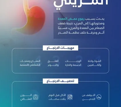 تجمع القصيم الصحي يكشف مهيجات الارتجاع المريئي وخمس نصائح للوقاية منه