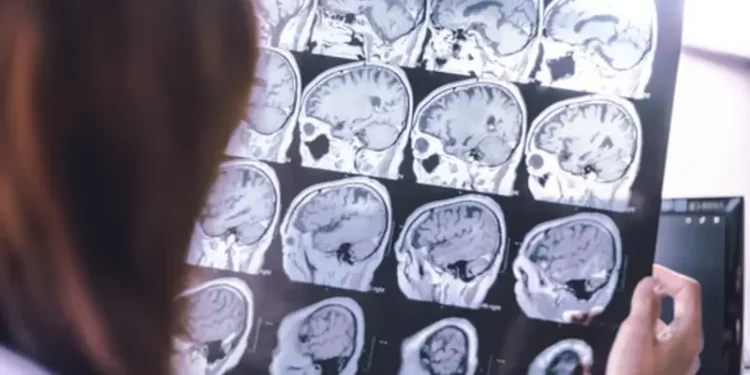 8 طرق علمية تقلل خطر الإصابة بالخرف والزهايمر.. .. تعرَّف عليها