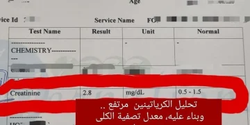 استشاري: حكة شديدة تكشف قصورًا كلويًا متقدمًا لدى مريضة سكري