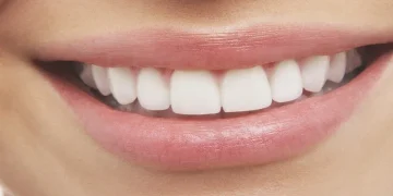 طبيبة تكشف 5 عوامل خفية تُضعف مينا الأسنان.. بعضها لا علاقة له بالحلويات
