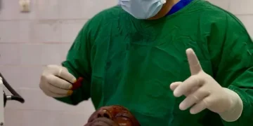 الندوة العالمية للشباب الإسلامي تُجري 217 عملية جراحية للعيون في الكاميرون