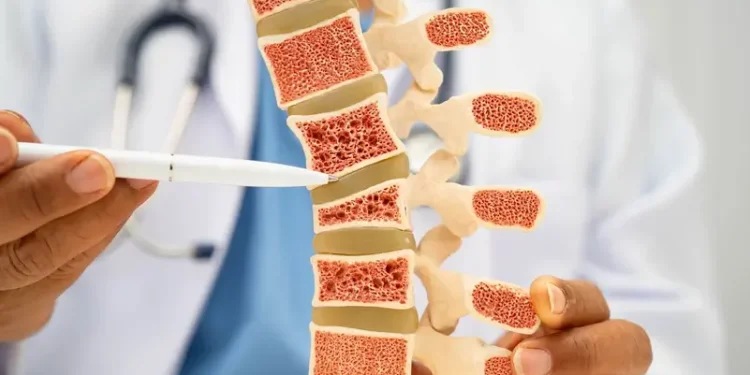 هل الحليب وحده يكفي لعظام قوية؟ 5 أطعمة قد تمنحك الكالسيوم وعناصر تعزز صحة العظام