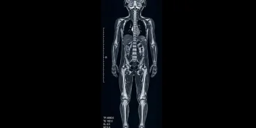 تجمع الطائف الصحي يفعّل فحص الرنين المغناطيسي لكامل الجسم للأطفال