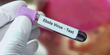 نيجيريا تسجل أول إصابة بإيبولا قادمة من أوغندا وتتتبع 44 مخالطاً
